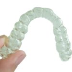 マウスガードやマウスピースを使ったいびきの治療法を知ろう